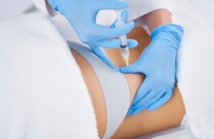 Rozmowa o lipolizie: wszystko, co musisz wiedzieć o nieinwazyjnej metodzie modelowania ciała